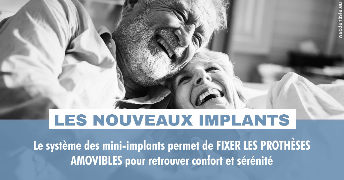 https://dr-lecarboulec-yann.chirurgiens-dentistes.fr/Les nouveaux implants 2