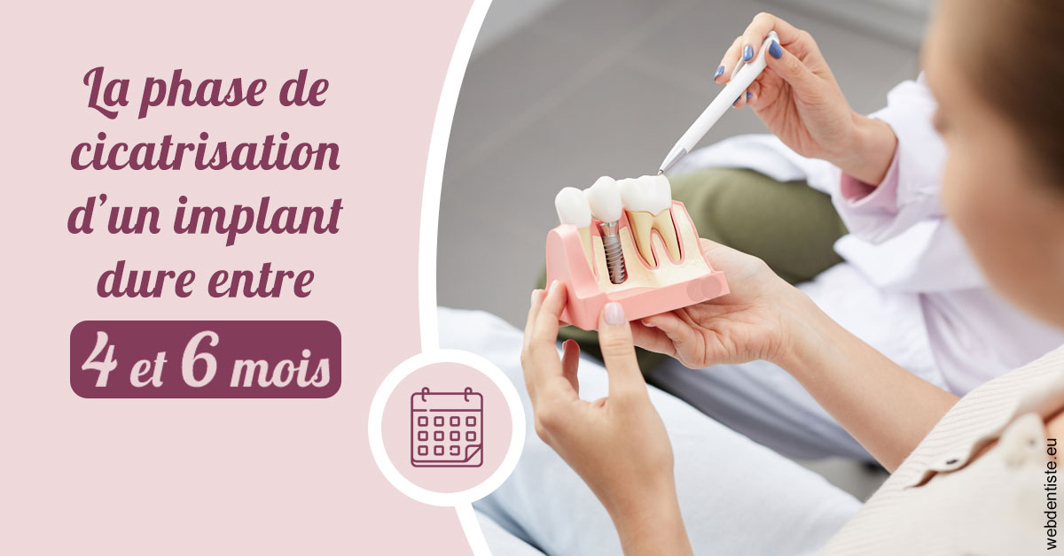 https://dr-lecarboulec-yann.chirurgiens-dentistes.fr/Cicatrisation implant 2