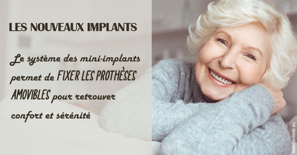 https://dr-lecarboulec-yann.chirurgiens-dentistes.fr/Les nouveaux implants 1