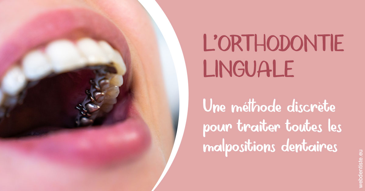https://dr-lecarboulec-yann.chirurgiens-dentistes.fr/L'orthodontie linguale 2
