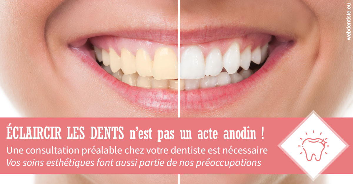 https://dr-lecarboulec-yann.chirurgiens-dentistes.fr/Eclaircir les dents 1