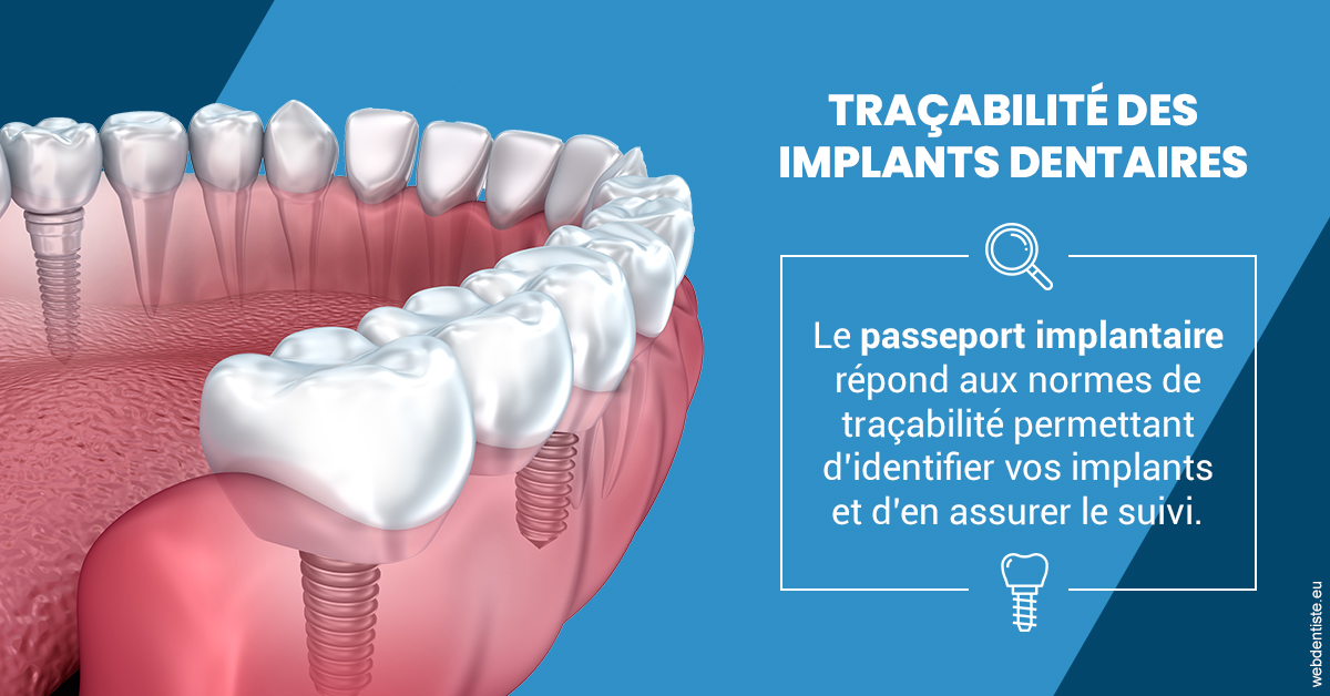 https://dr-lecarboulec-yann.chirurgiens-dentistes.fr/T2 2023 - Traçabilité des implants 1