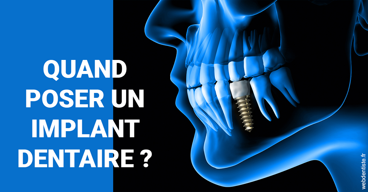 https://dr-lecarboulec-yann.chirurgiens-dentistes.fr/Les implants 1