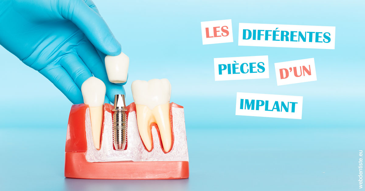 https://dr-lecarboulec-yann.chirurgiens-dentistes.fr/Les différentes pièces d’un implant 2