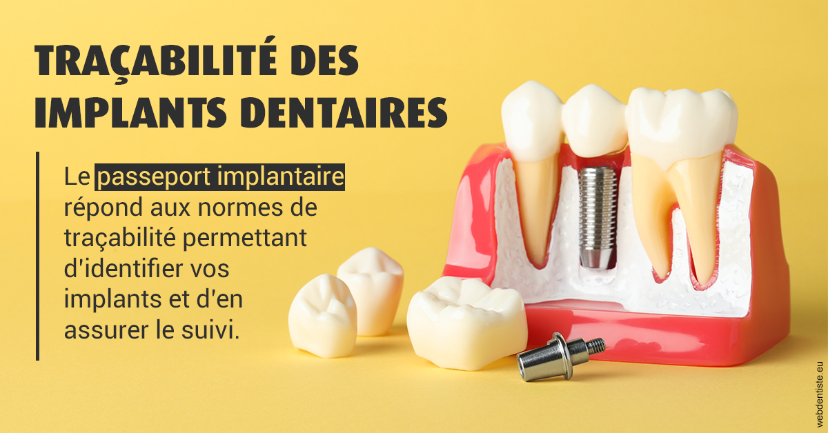 https://dr-lecarboulec-yann.chirurgiens-dentistes.fr/T2 2023 - Traçabilité des implants 2