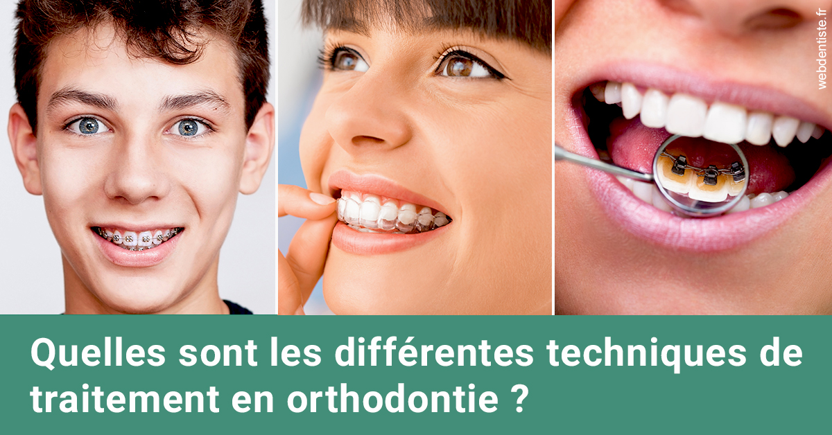 https://dr-lecarboulec-yann.chirurgiens-dentistes.fr/Les différentes techniques de traitement 2