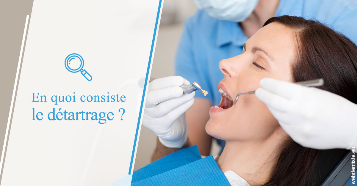 https://dr-lecarboulec-yann.chirurgiens-dentistes.fr/En quoi consiste le détartrage