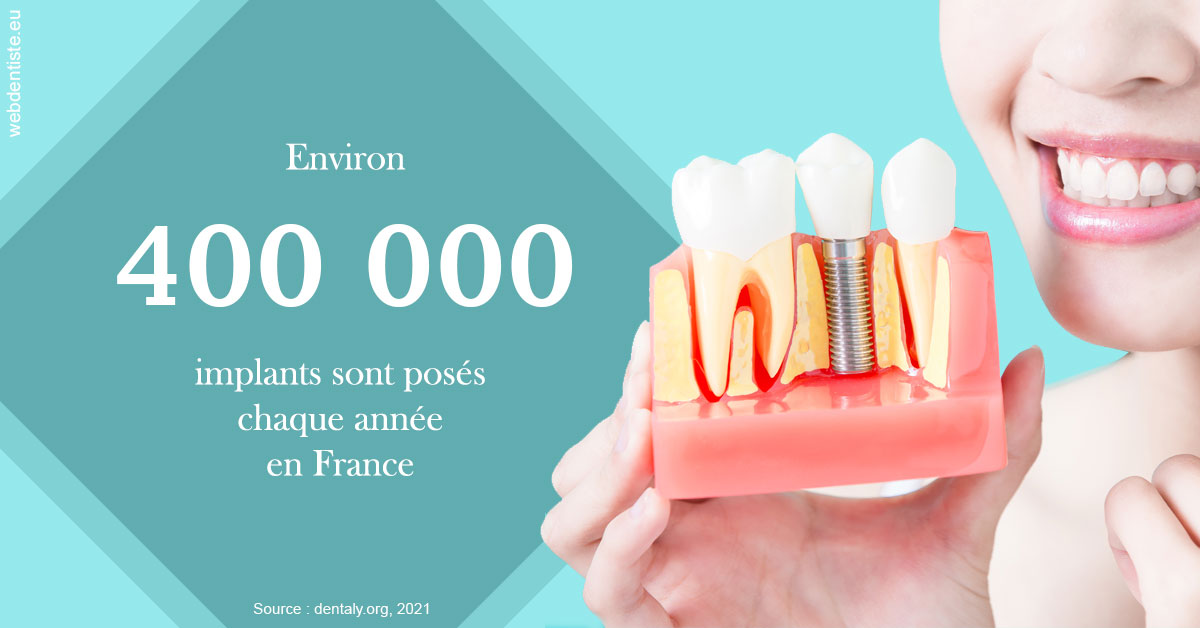 https://dr-lecarboulec-yann.chirurgiens-dentistes.fr/Pose d'implants en France 2