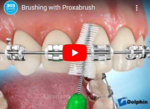 Brushing with Proxabrush