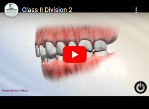 Class II Division 2
